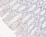 MUM1 Antibody in Immunohistochemistry (Paraffin) (IHC (P))