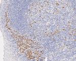 MUM1 Antibody in Immunohistochemistry (Paraffin) (IHC (P))