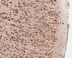 EEF1G Antibody in Immunohistochemistry (Paraffin) (IHC (P))