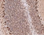 EEF1G Antibody in Immunohistochemistry (Paraffin) (IHC (P))