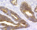 Cytokeratin 20 Antibody in Immunohistochemistry (Paraffin) (IHC (P))