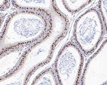 PAX2 Antibody in Immunohistochemistry (Paraffin) (IHC (P))