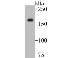 Neurocan Antibody in Western Blot (WB)