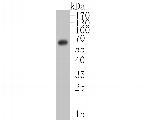 Estrogen Receptor alpha Antibody in Western Blot (WB)