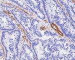 Integrin beta 3 Antibody in Immunohistochemistry (Paraffin) (IHC (P))