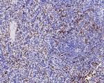 Integrin beta 3 Antibody in Immunohistochemistry (Paraffin) (IHC (P))