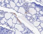 Integrin beta 3 Antibody in Immunohistochemistry (Paraffin) (IHC (P))