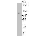 Integrin beta 3 Antibody in Western Blot (WB)