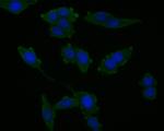 CHMP2B Antibody in Immunocytochemistry (ICC/IF)