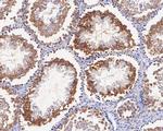 CHMP2B Antibody in Immunohistochemistry (Paraffin) (IHC (P))