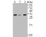 CHMP2B Antibody in Western Blot (WB)