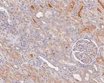 KLC1 Antibody in Immunohistochemistry (Paraffin) (IHC (P))