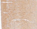 KLC1 Antibody in Immunohistochemistry (Paraffin) (IHC (P))