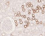 APLP2 Antibody in Immunohistochemistry (Paraffin) (IHC (P))