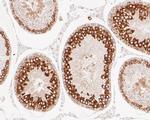 APLP2 Antibody in Immunohistochemistry (Paraffin) (IHC (P))