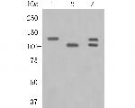 APLP2 Antibody in Western Blot (WB)