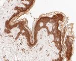 EphB3 Antibody in Immunohistochemistry (Paraffin) (IHC (P))