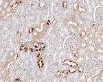 EphB3 Antibody in Immunohistochemistry (Paraffin) (IHC (P))