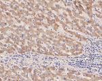 DPYD Antibody in Immunohistochemistry (Paraffin) (IHC (P))