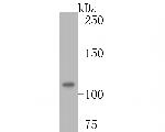 DPYD Antibody in Western Blot (WB)