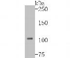 DPYD Antibody in Western Blot (WB)