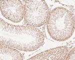 NFYA Antibody in Immunohistochemistry (Paraffin) (IHC (P))