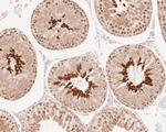 BAT3 Antibody in Immunohistochemistry (Paraffin) (IHC (P))