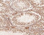 LMAN1 Antibody in Immunohistochemistry (Paraffin) (IHC (P))