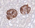 CD35 Antibody in Immunohistochemistry (Paraffin) (IHC (P))