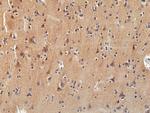 TrkA/TrkB/TrkC Antibody in Immunohistochemistry (Paraffin) (IHC (P))