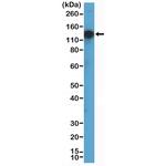 TrkA/TrkB/TrkC Antibody in Western Blot (WB)