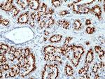 Prostein Antibody in Immunohistochemistry (Paraffin) (IHC (P))