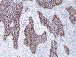 SOX2 Antibody in Immunohistochemistry (Paraffin) (IHC (P))