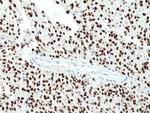 SOX2 Antibody in Immunohistochemistry (Paraffin) (IHC (P))