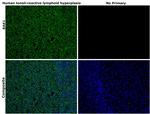 BAK1 Antibody in Immunohistochemistry (Paraffin) (IHC (P))