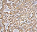 BAK1 Antibody in Immunohistochemistry (Paraffin) (IHC (P))