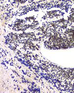 RPA70 Antibody in Immunohistochemistry (Paraffin) (IHC (P))