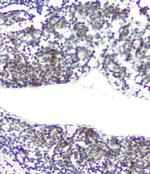 RPA70 Antibody in Immunohistochemistry (Paraffin) (IHC (P))