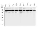 RPA70 Antibody in Western Blot (WB)