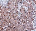 HSPH1 Antibody in Immunohistochemistry (Paraffin) (IHC (P))