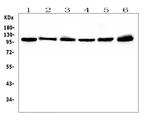 HSPH1 Antibody in Western Blot (WB)