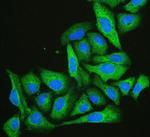 CFL2 Antibody in Immunocytochemistry (ICC/IF)