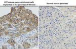 Ras (G12D Mutant) Antibody in Immunohistochemistry (Paraffin) (IHC (P))