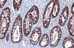 GPX2 Antibody in Immunohistochemistry (Paraffin) (IHC (P))