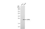 GPX2 Antibody in Western Blot (WB)