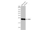 GPX2 Antibody in Western Blot (WB)