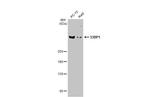 53BP1 Antibody in Western Blot (WB)