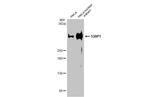 53BP1 Antibody in Western Blot (WB)