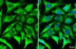 ACSL4/FACL4 Antibody in Immunocytochemistry (ICC/IF)