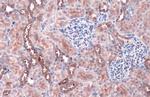 ACSL4/FACL4 Antibody in Immunohistochemistry (Paraffin) (IHC (P))